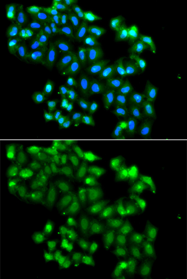 Anti-PHF11 Antibody