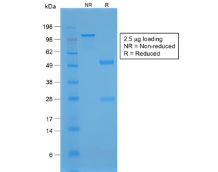 SDS-PAGE analysis of purified, BSA-free recombinant NKX2.1 antibody (clone NX2.1/1855R) as confirmation of integrity and purity.