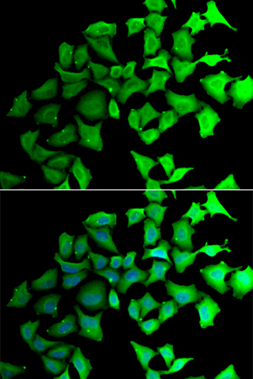 Anti-TALDO1 Antibody
