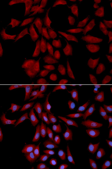 Anti-UBE2I Antibody