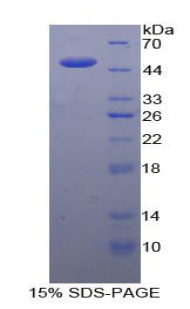 Figure. SDS-PAGE