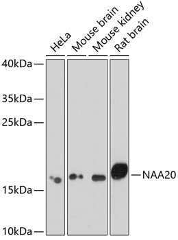 Anti-NAA20 Antibody