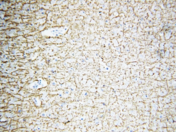 IHC-P: MBP antibody testing of rat brain tissue. HIER: boil tissue sections in pH6, 10mM citrate buffer, for 10-20 min and allow to cool before testing.