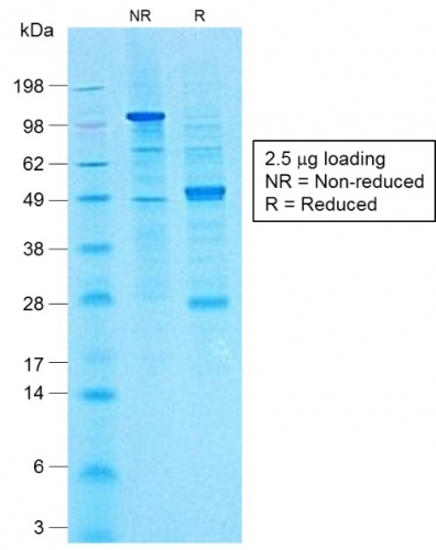 Anti-CA19-9 Antibody [CA19.9/1390R]