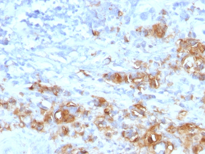 Anti-CA19-9 Antibody [CA19.9/1390R]