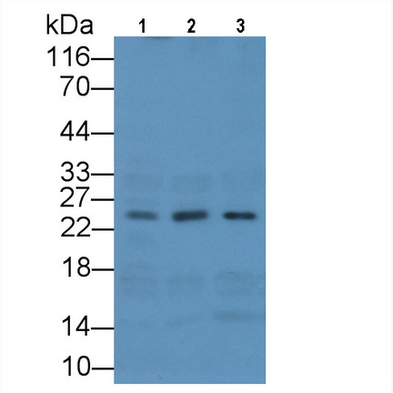 Western Blot; Sample: Lane1: Rat Liver lysate; Lane2: Rat Kidney lysate; Lane3: Porcine Kidney lysate Primary Ab: 3µg/ml Mouse Anti-Human MSRA Antibody Second Ab: 0.2µg/mL HRP-Linked Caprine Anti-Mouse IgG Polyclonal Antibody (Catalog: SAA544Mu19)