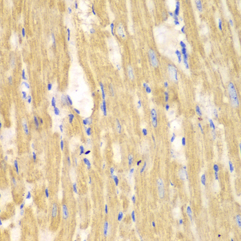 Anti-CAPN1 Antibody