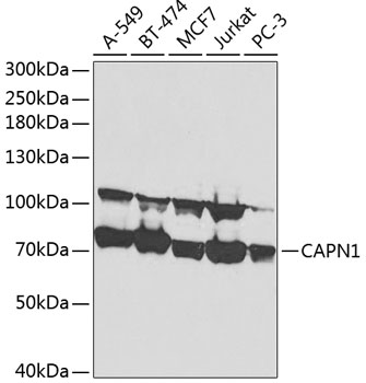 Anti-CAPN1 Antibody