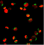 Anti-PML Protein Antibody