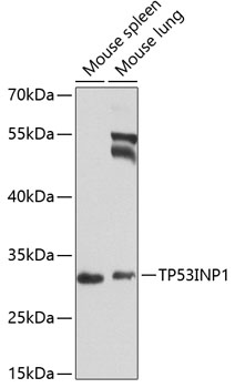 Anti-TP53INP1 Antibody