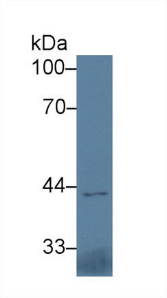 Western Blot; Sample: Mouse Heart lysate; Primary Ab: 3µg/ml Rabbit Anti-Mouse IL5Ra Antibody Second Ab: 0.2µg/mL HRP-Linked Caprine Anti-Rabbit IgG Polyclonal Antibody