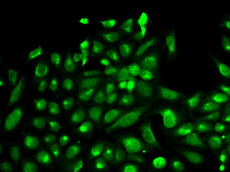 Anti-SPHK1 Antibody