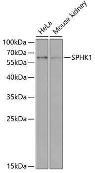 Anti-SPHK1 Antibody