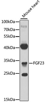 Anti-FGF23 Antibody