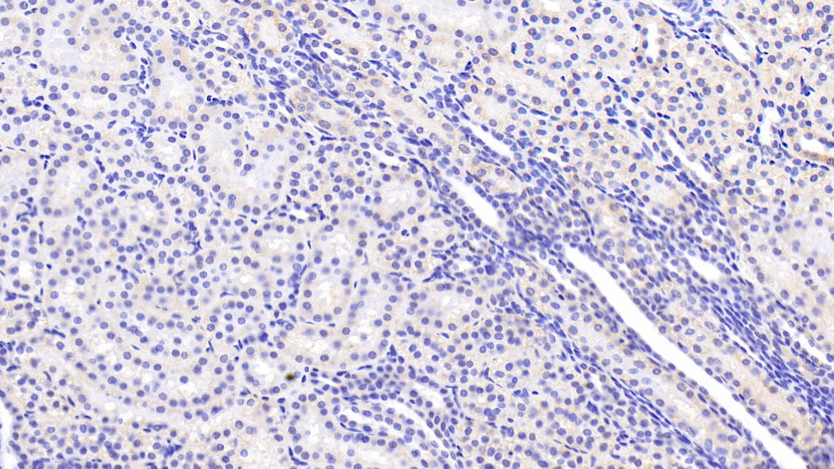 DAB staining on IHC-P; Sample: Human Kidney Tissue;  Primary Ab: 20µg/ml Mouse Anti-Human Hsp60 Antibody Second Ab: 2µg/mL HRP-Linked Caprine Anti-Mouse IgG Polyclonal Antibody (Catalog: SAA544Mu19)