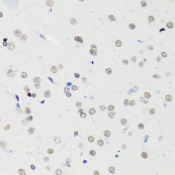 Anti-Histone H4 (acetyl K5) Antibody