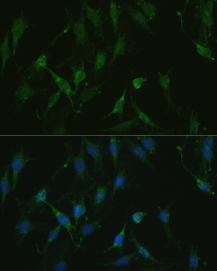 Anti-TRPV1 Antibody