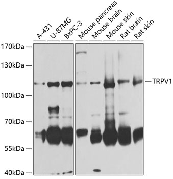 Anti-TRPV1 Antibody