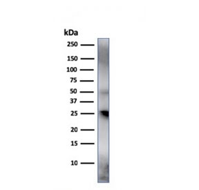 Western blot testing of human spleen lysate with TIM3 antibody. Expected molecular weight: 33-70 kDa depending on glycosylation level.
