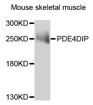Anti-PDE4DIP Antibody