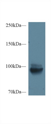 Western Blot; Sample: Mouse Kidney lysate; <br/>Primary Ab: 1µg/ml Rabbit Anti-Mouse MEP1a Antibody<br/>Second Ab: 0.2µg/mL HRP-Linked Caprine Anti-Rabbit IgG Polyclonal Antibody<br/>(Catalog: SAA544Rb19)
