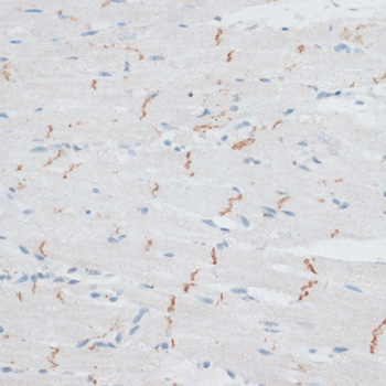 Anti-CDH2 Antibody