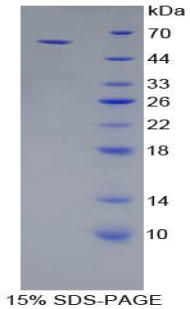 Figure. SDS-PAGE