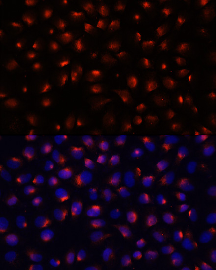 Anti-ACTN3 Antibody