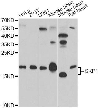 Anti-SKP1 Antibody