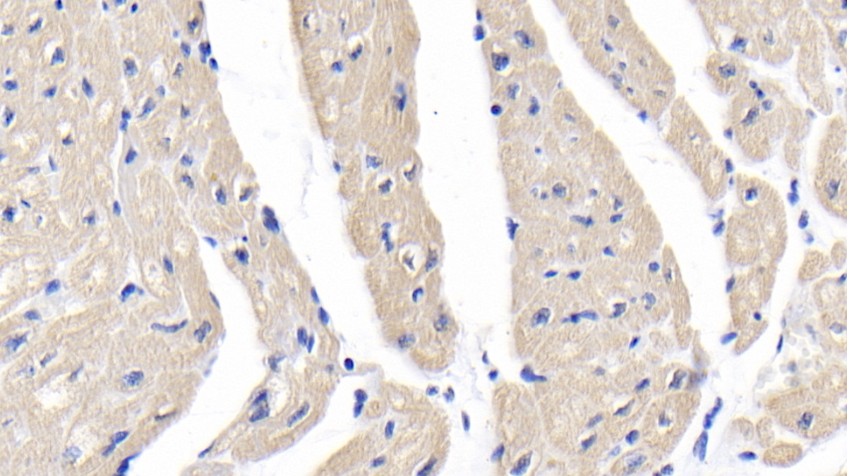 DAB staining on IHC-P;<br/>Sample: Human Cardiac Muscle Tissue; <br/>Primary Ab: 20µg/ml Mouse Anti-Human MYH7 Antibody<br/>Second Ab: 2µg/mL HRP-Linked Caprine Anti-Mouse IgG Polyclonal Antibody<br/>(Catalog: SAA544Mu19)
