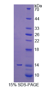 Figure. SDS-PAGE