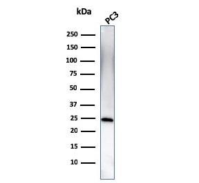 Western blot testing of human PC3 cell lysate with C1QA antibody. Predicted molecular weight ~26 kDa.