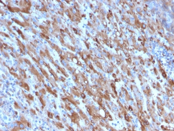 IHC staining of FFPE human liver with C1QA antibody. HIER: boil tissue sections in pH 9 10mM Tris with 1mM EDTA for 10-20 min and allow to cool before testing.