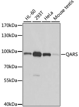 Anti-QARS Antibody