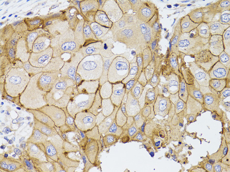Anti-PDE4D Antibody