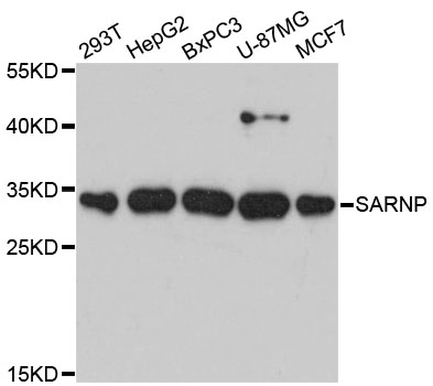 Anti-SARNP Antibody