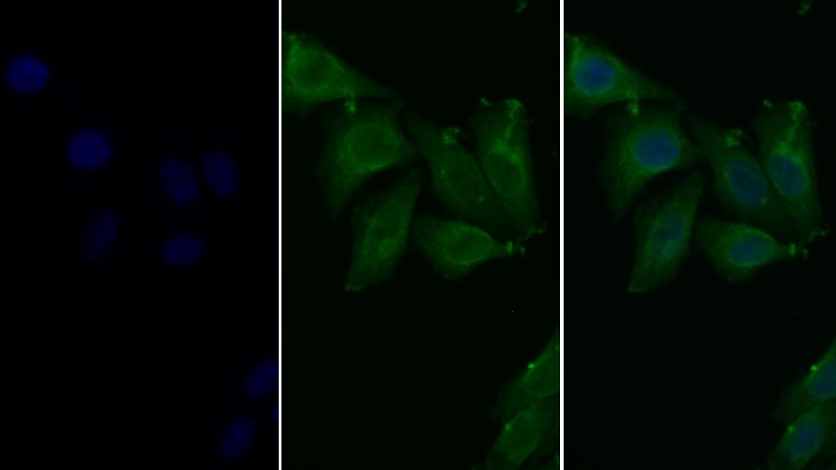 FITC staining on IF; Sample: Human HepG2 cell;  Primary Ab: 30µg/ml Mouse Anti-Rat ALB Antibody Second Ab: 5µg/ml FITC-Linked Caprine Anti-Mouse IgG Polyclonal Antibody (Catalog: SAA544Mu18)