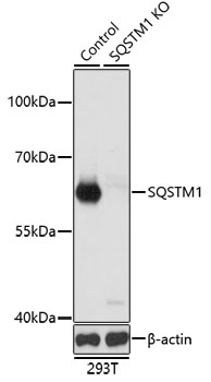 Anti-SQSTM1 Antibody