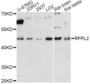 Anti-RFPL2 Antibody