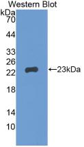 Western Blot; Sample: Recombinant GREM1, Human.