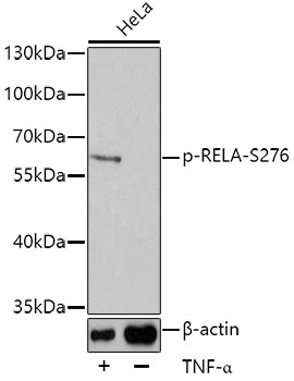 Anti-RELA (phospho S276) Antibody