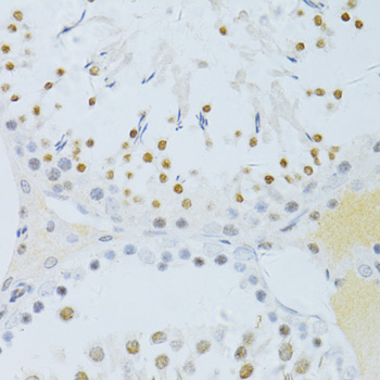 Anti-RELA (phospho S276) Antibody