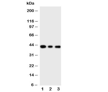 Western blot testing of MAPK13 antibody and Lane 1: PANC; 2: COLO320; 3: Jurkat cell lysate. Expected/observed size ~42KD
