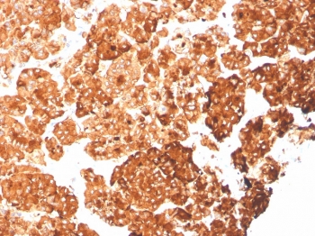 IHC staining of FFPE human pancreas with recombinant Cytokeratin 6A antibody (clone rKRT6A/2100). HIER: boil tissue sections in pH 9 10mM Tris with 1mM EDTA for 20 min and allow to cool before testing.