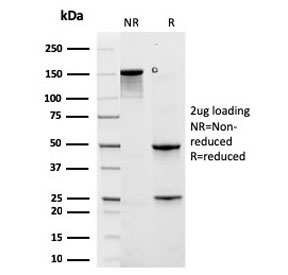 SDS-PAGE analysis of purified, BSA-free recombinant Cytokeratin 6A antibody (clone rKRT6A/2100) as confirmation of integrity and purity.
