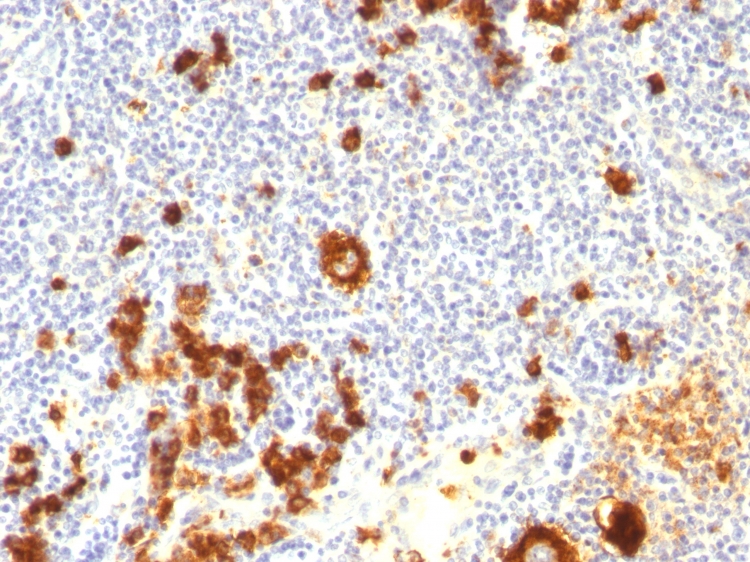 Anti-CD15 Antibody [FUT4/815 + BRA-4F1]