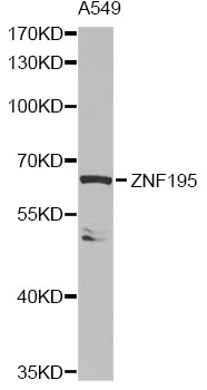 Anti-ZNF195 Antibody