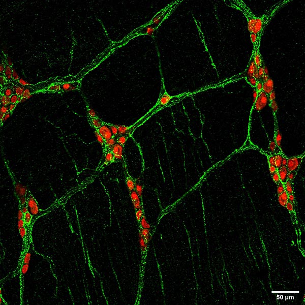 Substance P Antibody