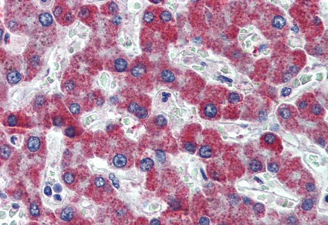 Anti-F2R Antibody