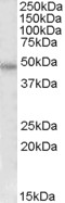 Anti-F2R Antibody